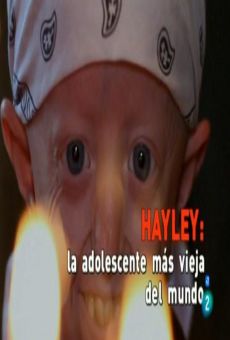 Hayley, World's Oldest Teenager