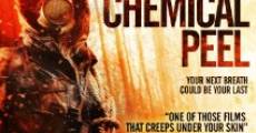 Filme completo Chemical Peel