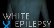 White Epilepsy streaming